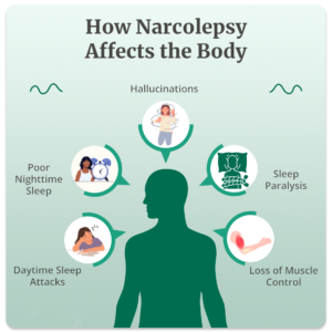 how narcolepsy affects the body